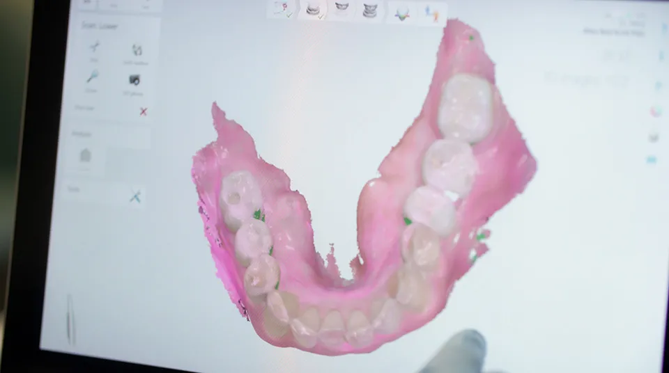 Ocoee Fl Night Guard Dentists